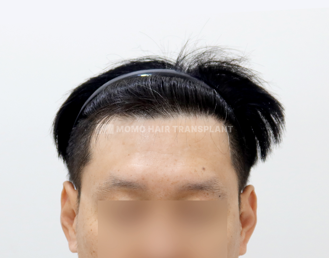 After