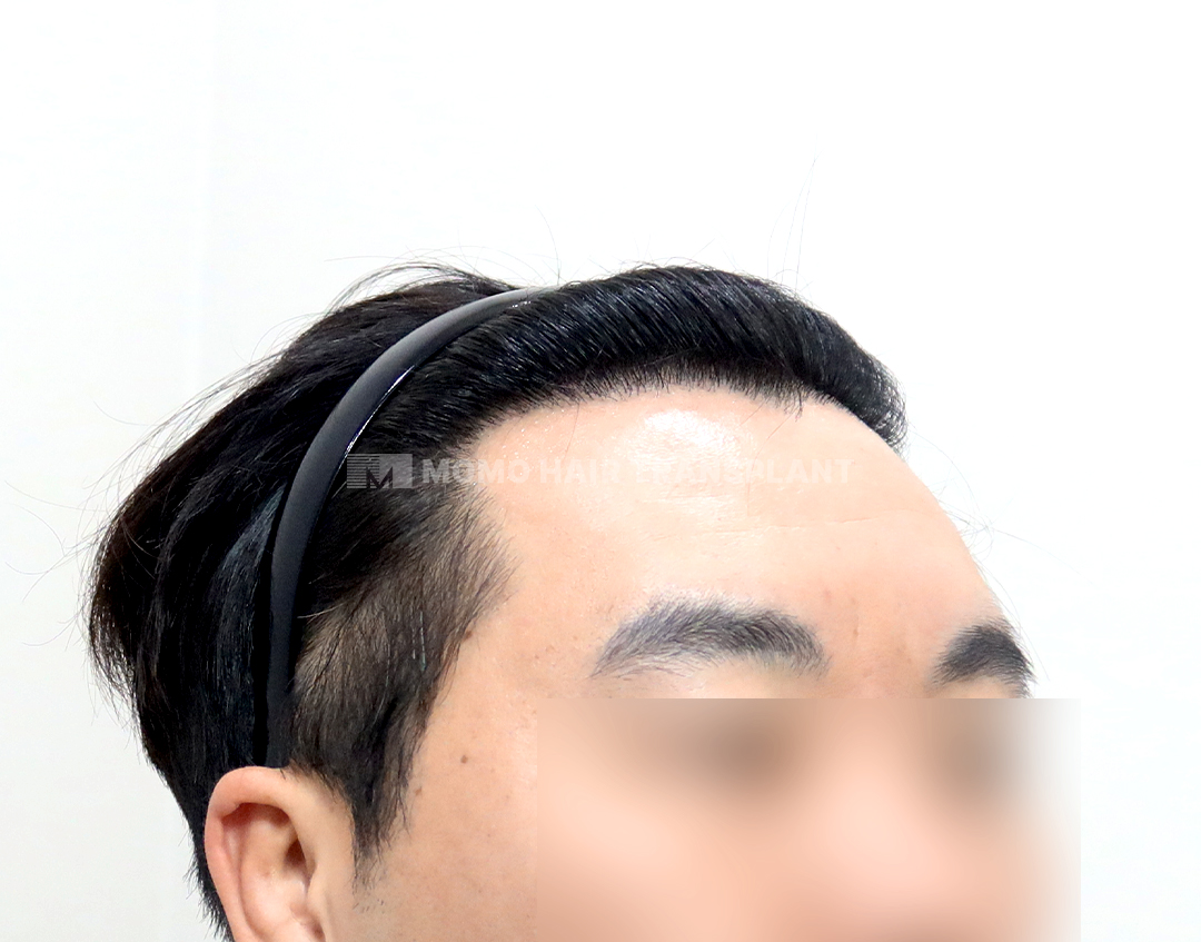After
