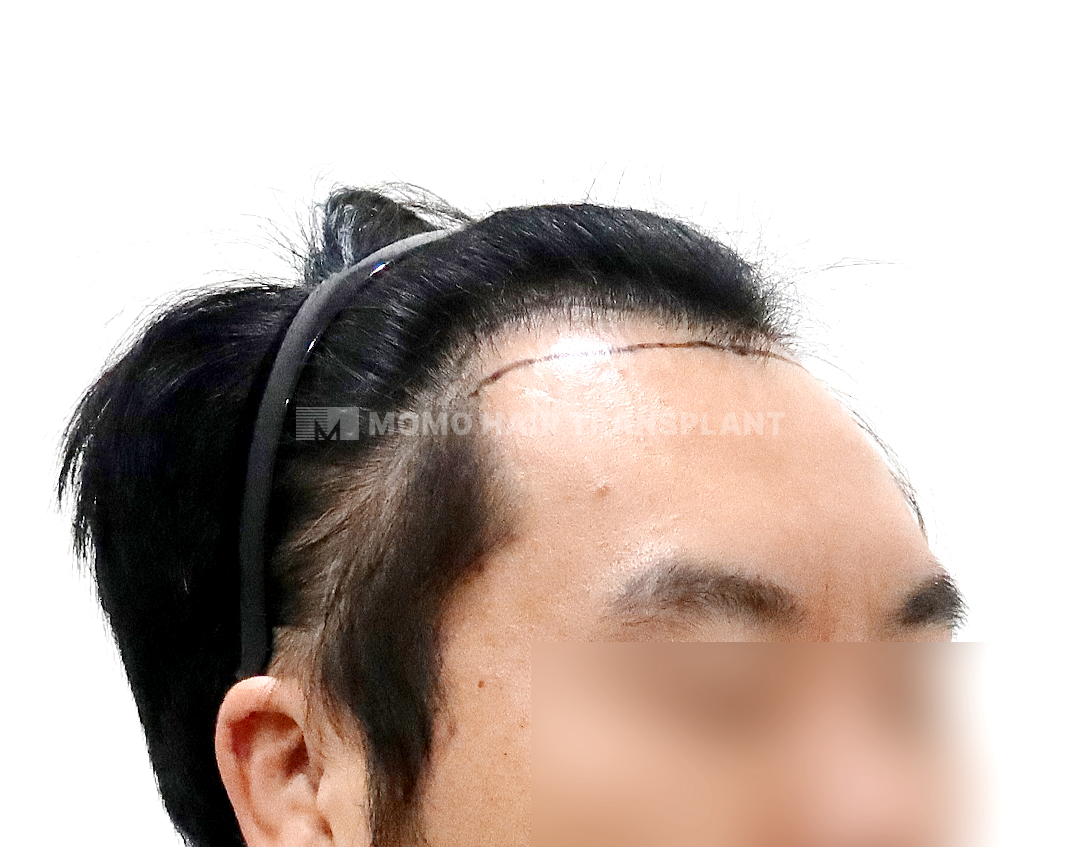 Before