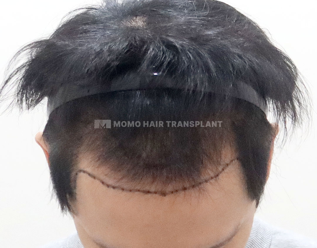Before