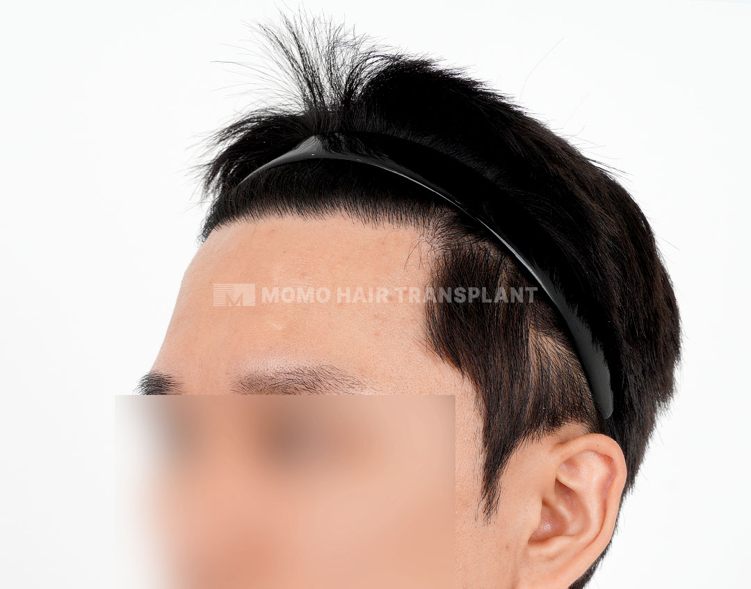 After