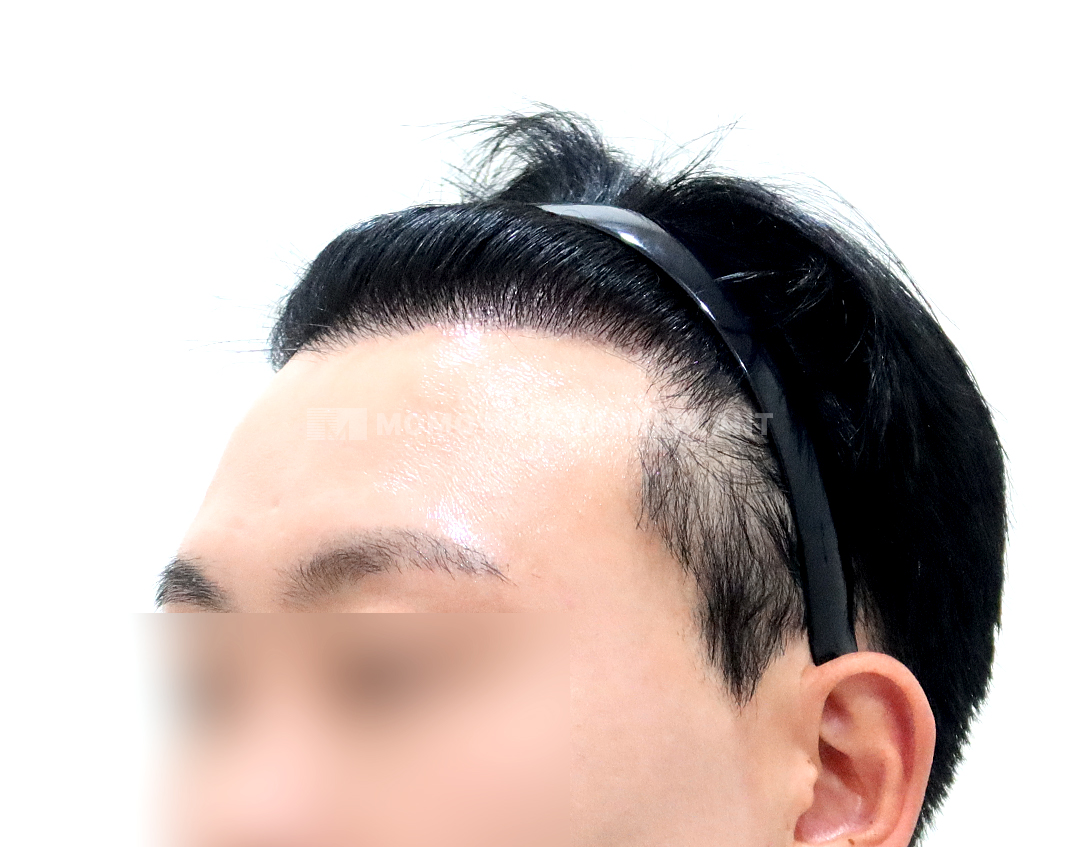 After