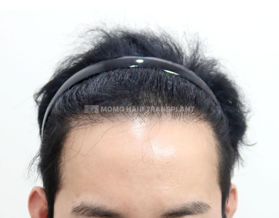 After
