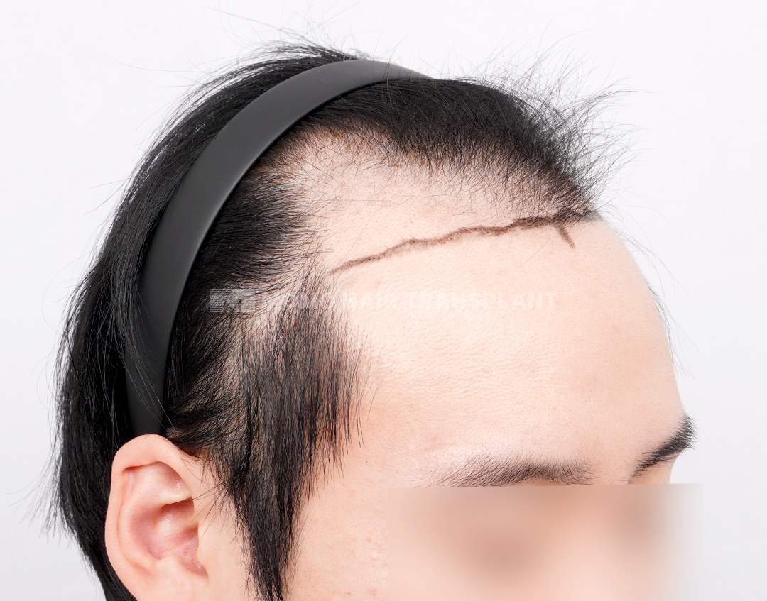 Before
