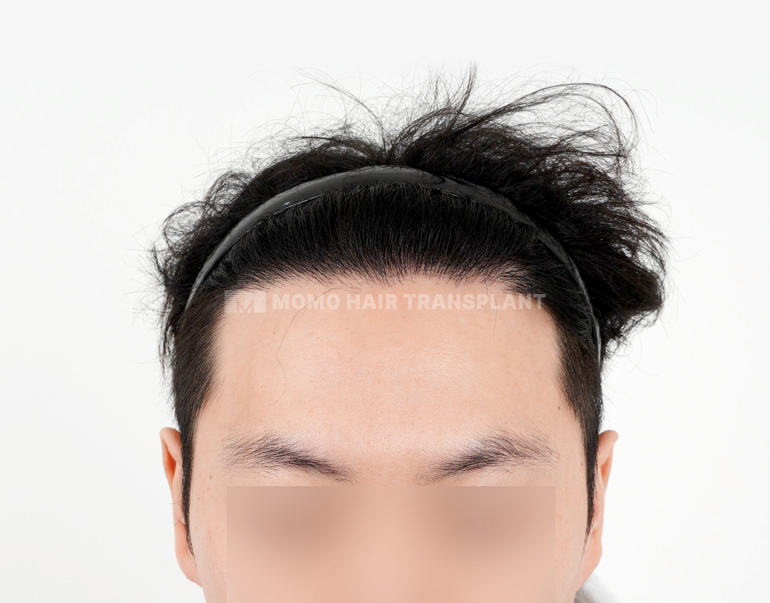 After