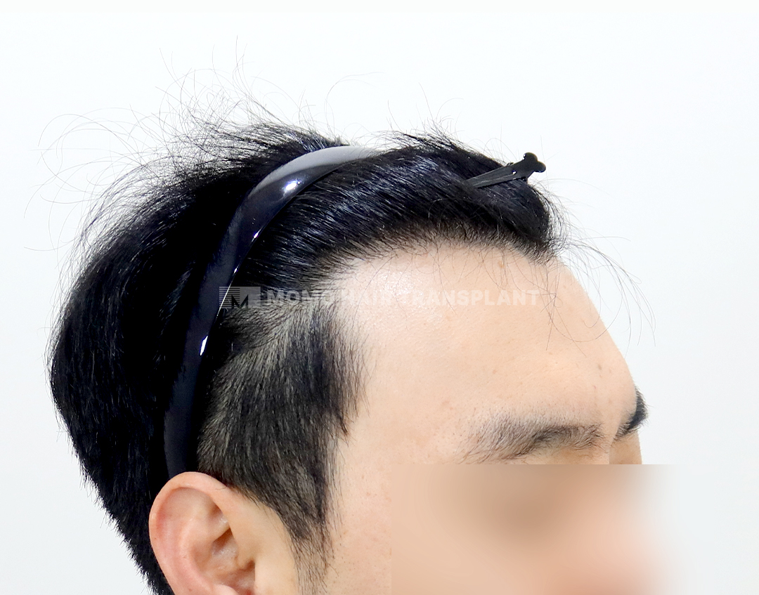 After