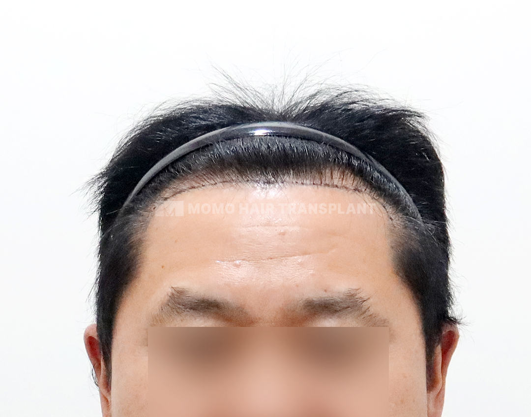 Before