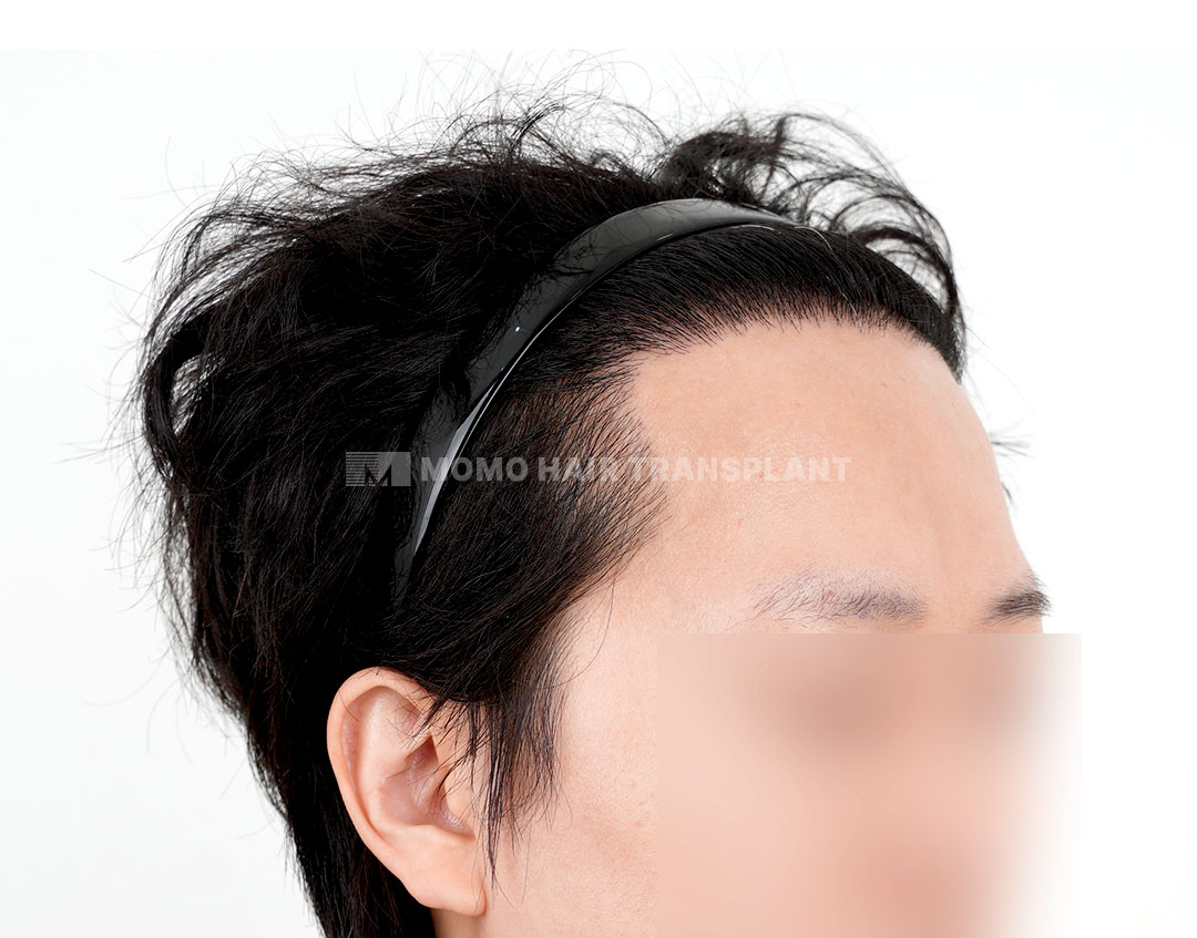 After