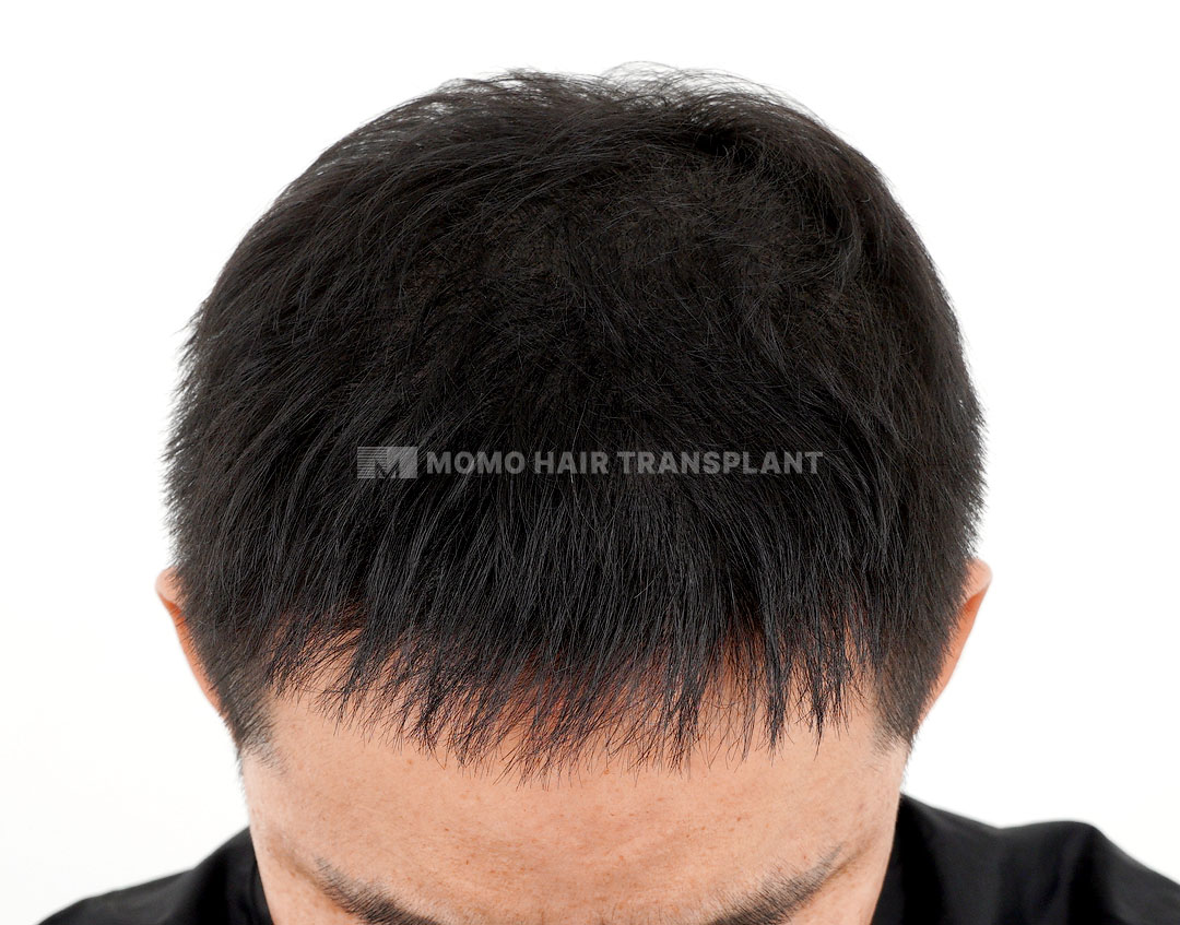 After