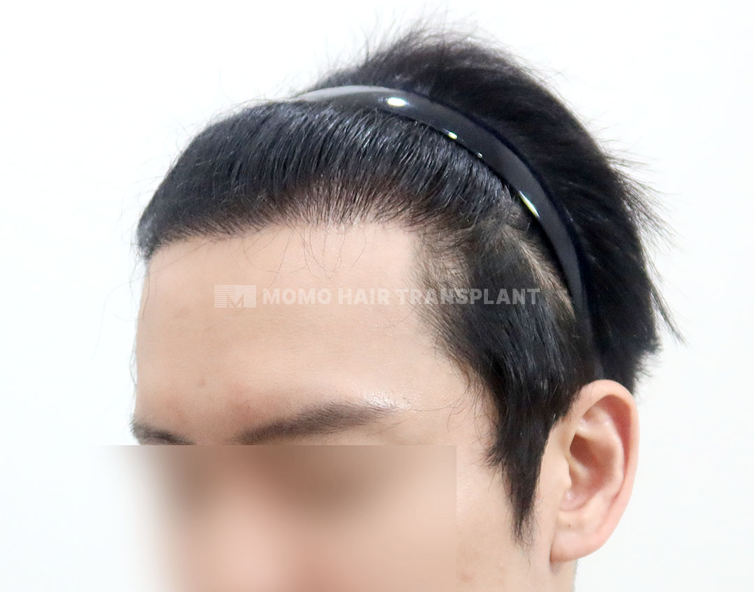 After