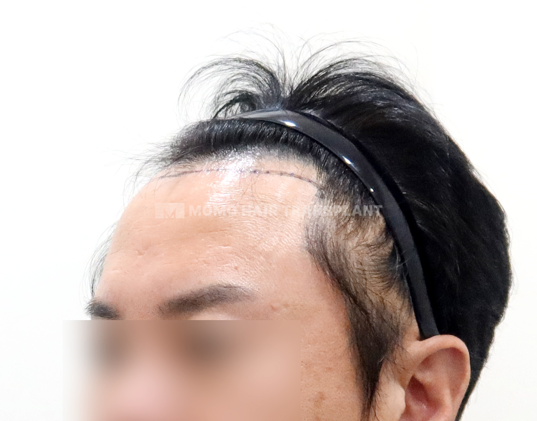 Before