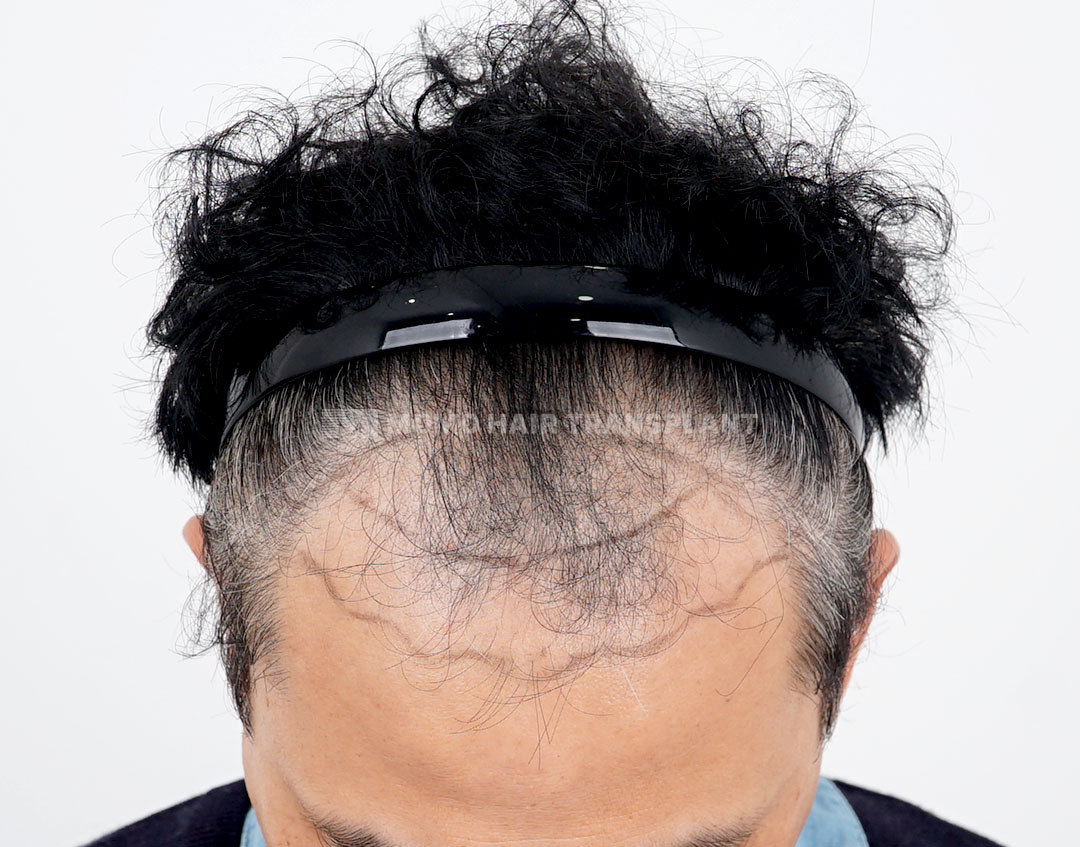 Before