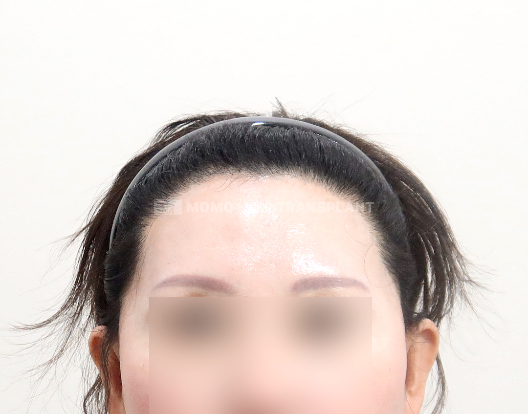 After