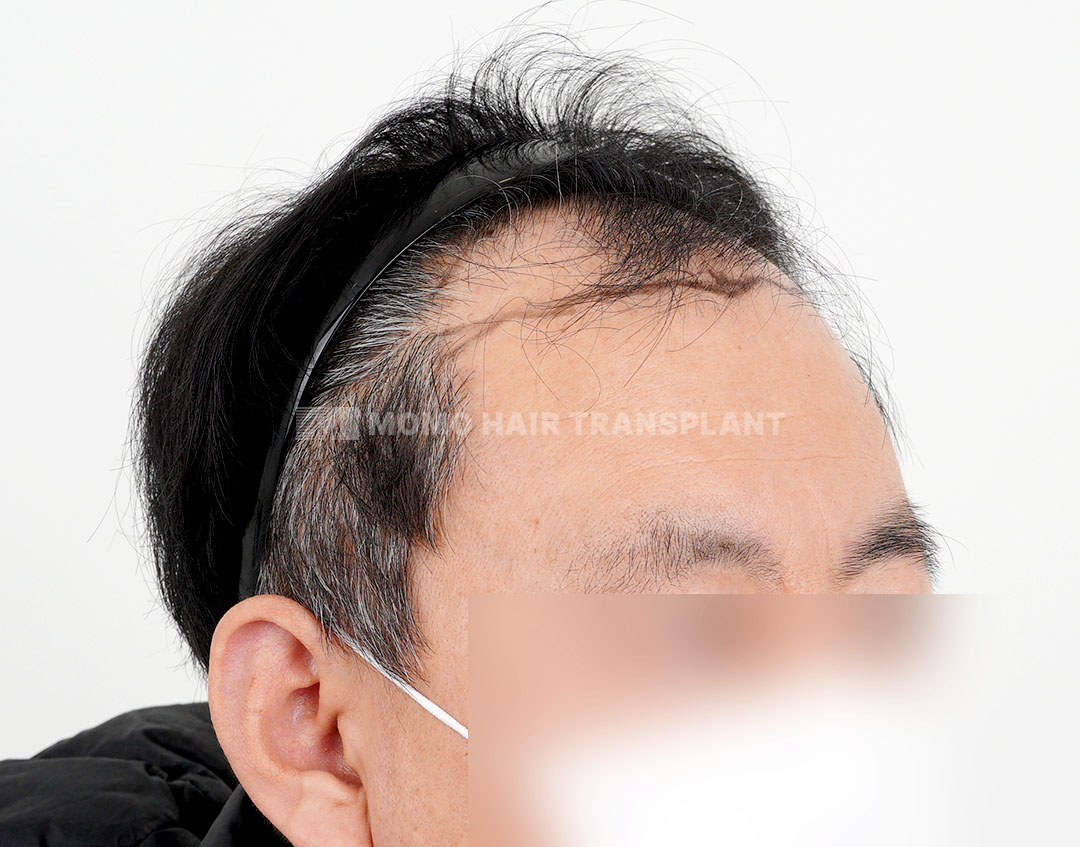 Before