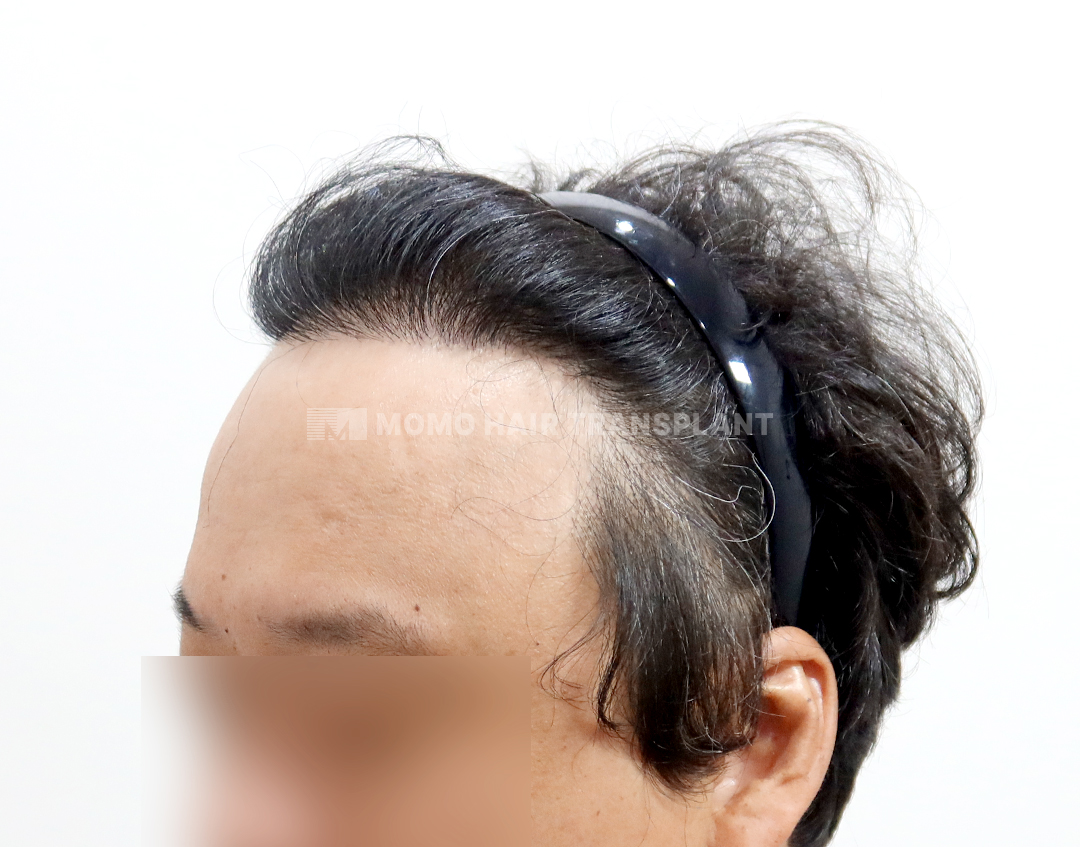 After