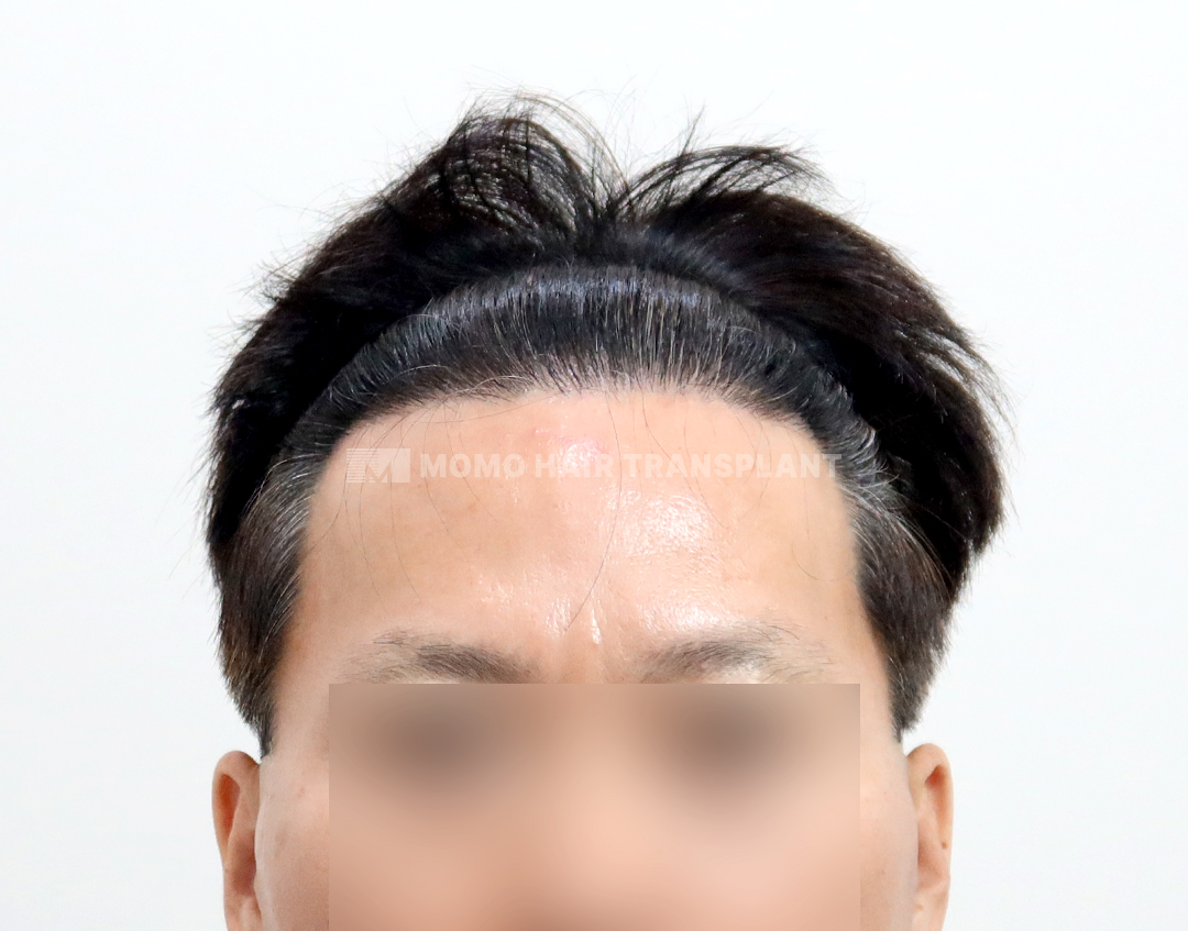 After