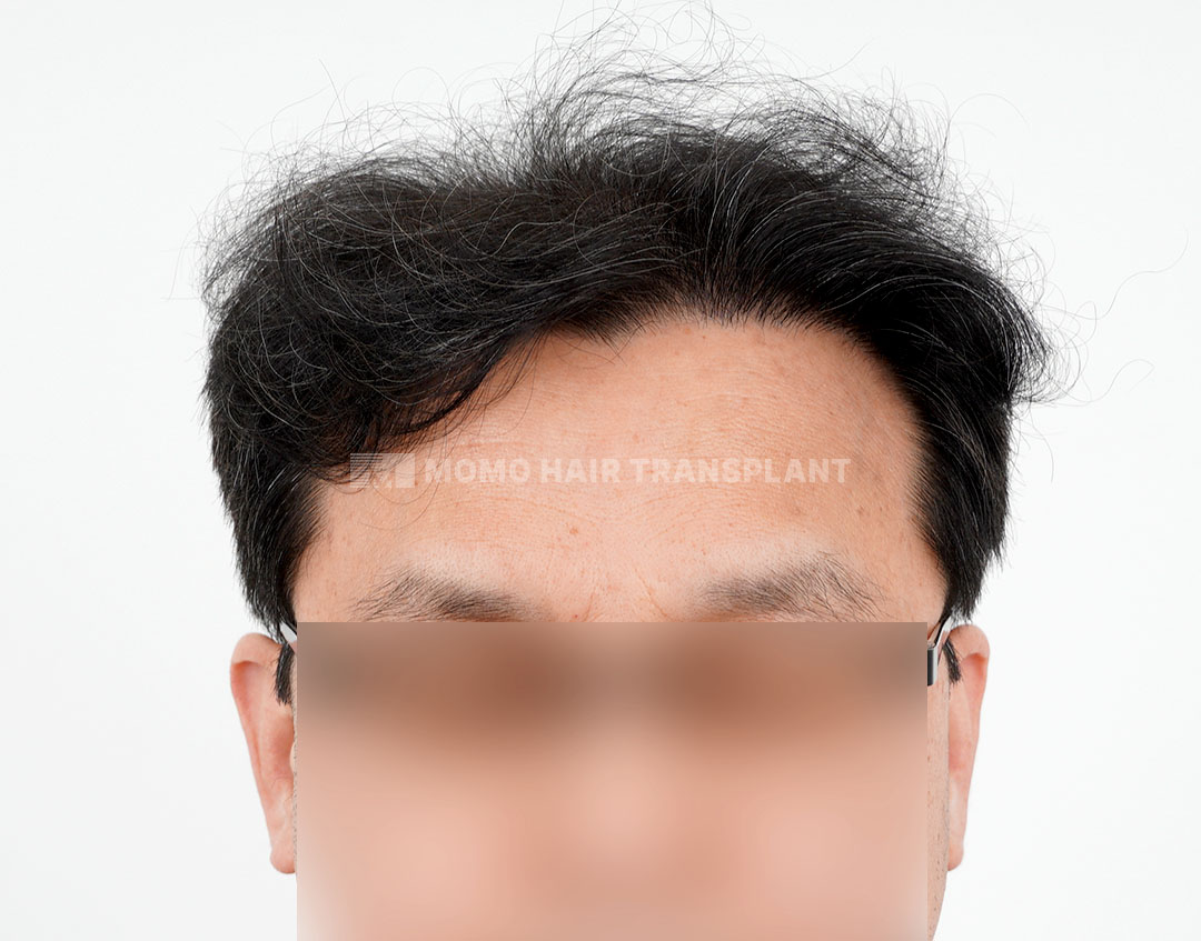 After