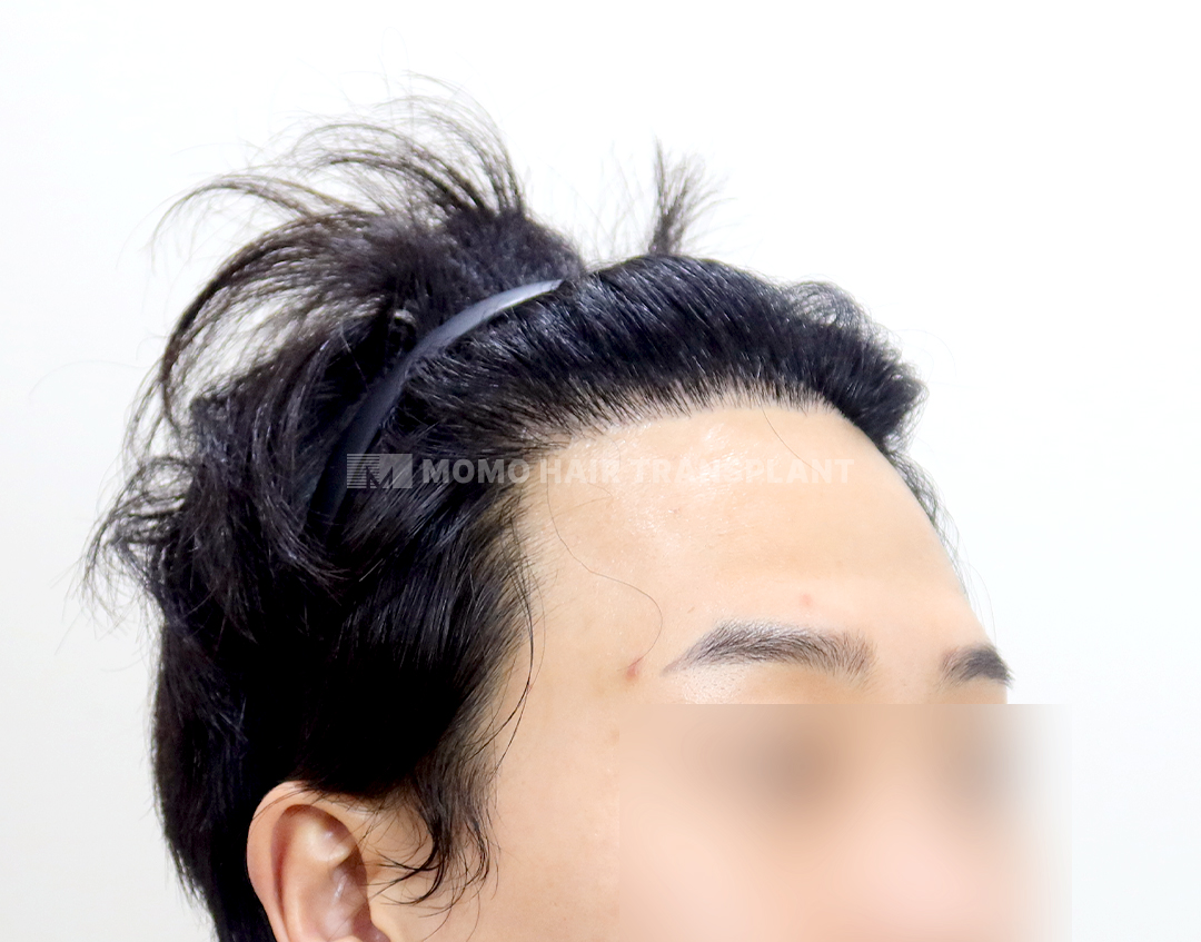 After