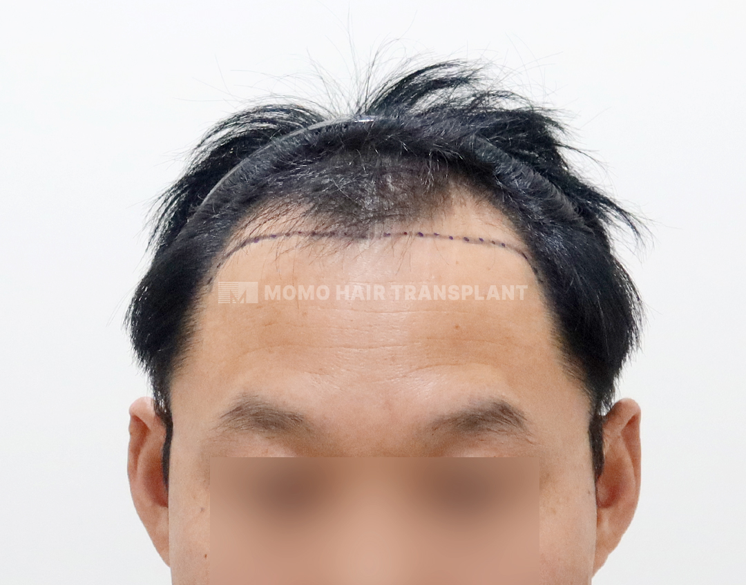 Before