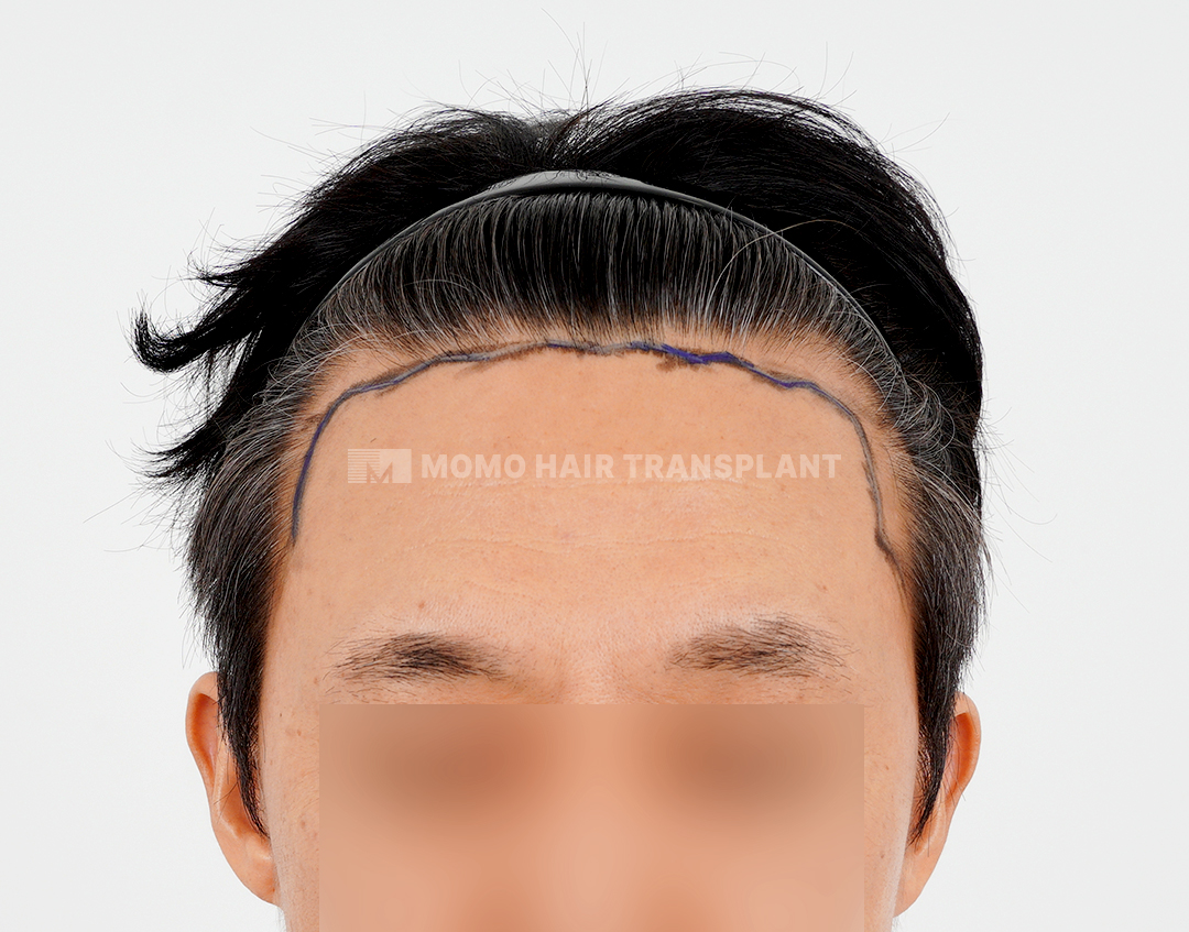 Before