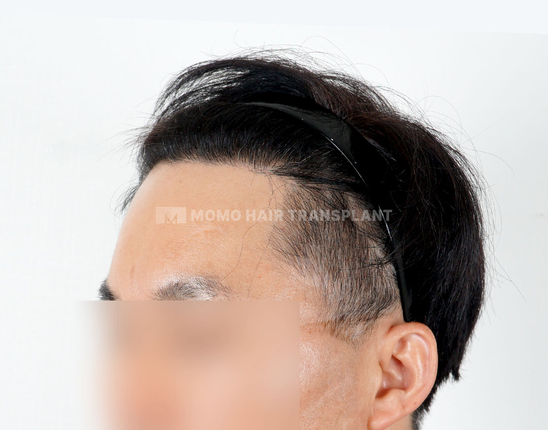 After