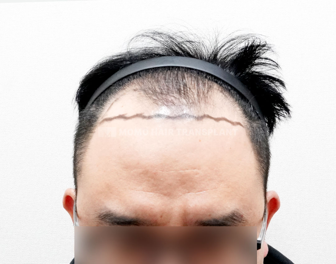 Before