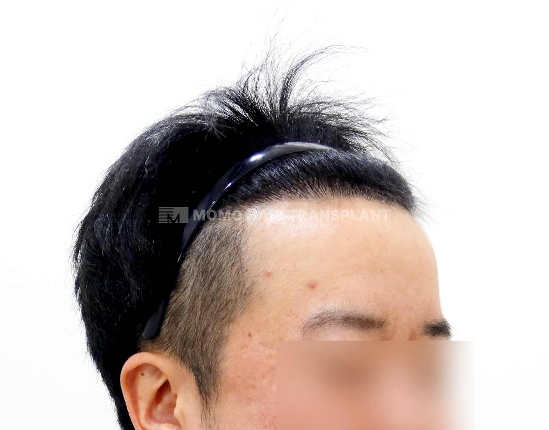 After
