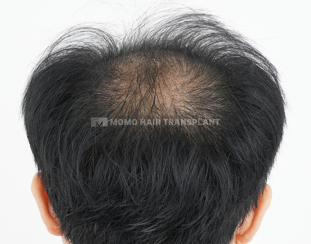 Before