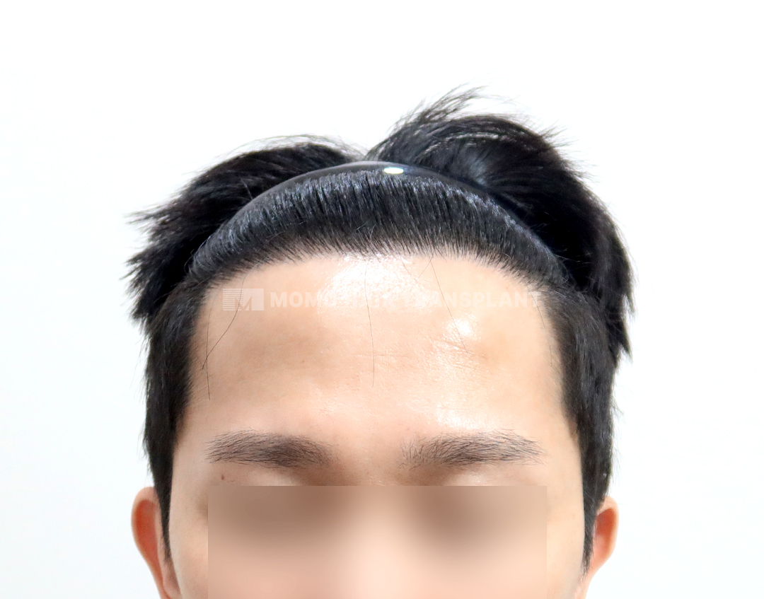 After