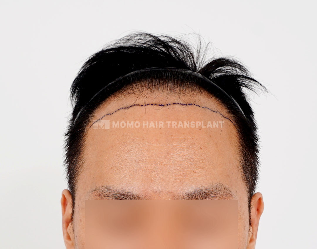 Before