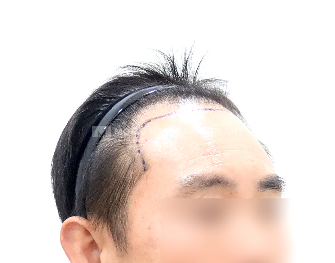 Before