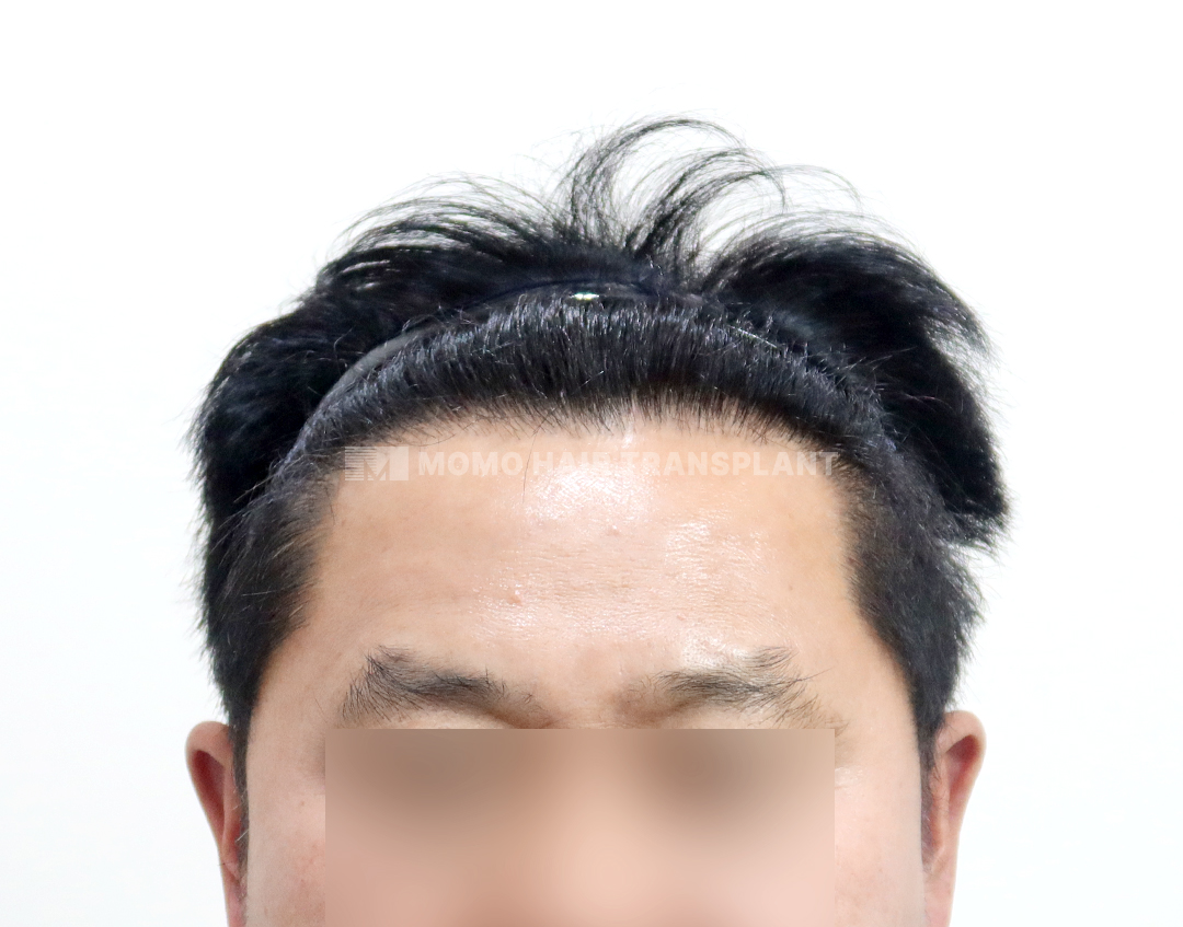 After