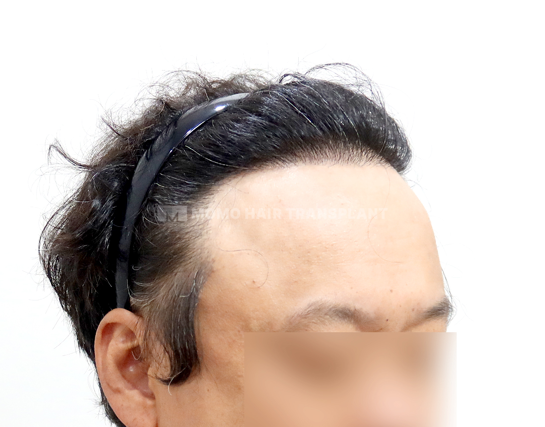 After