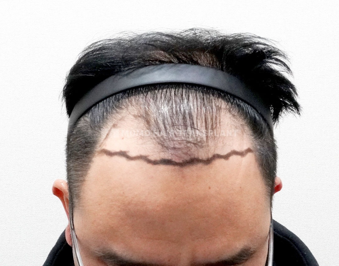 Before