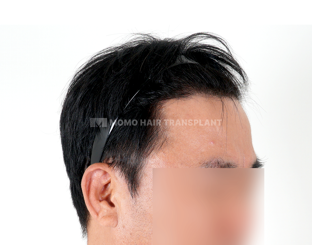 After