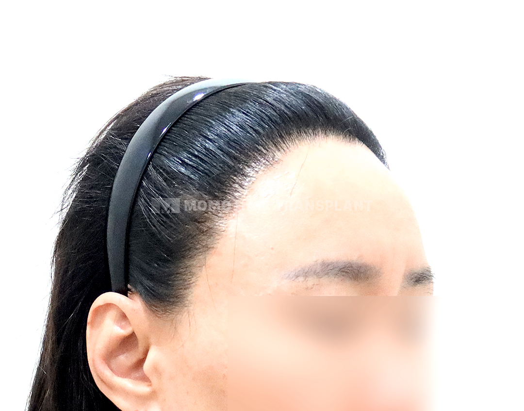 After