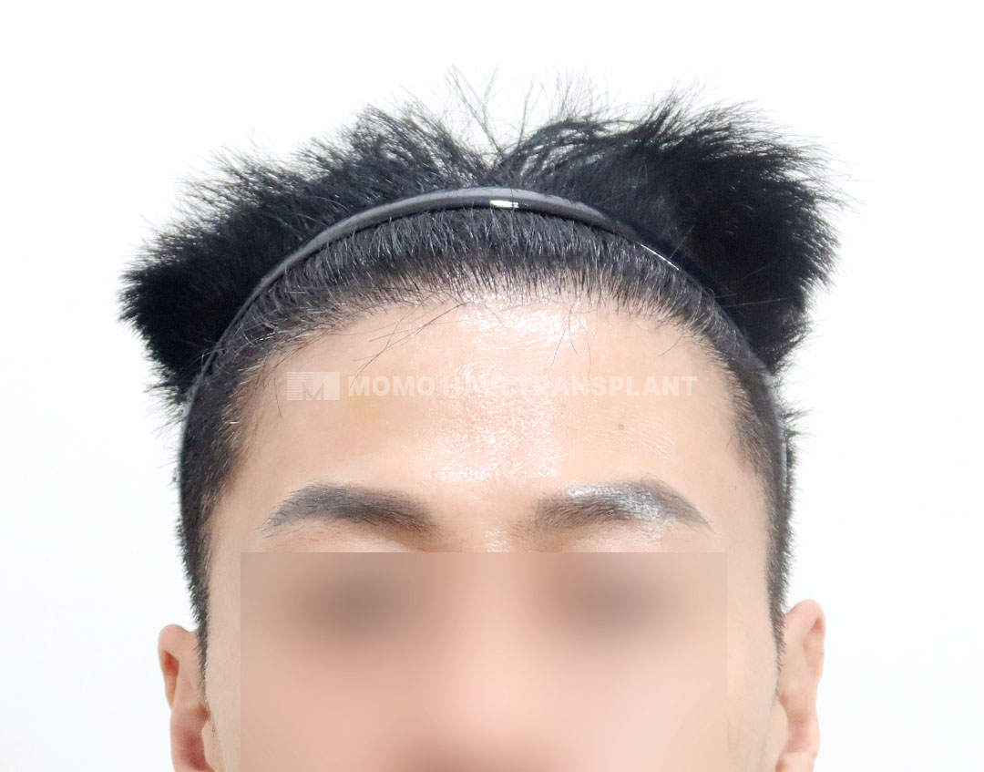 After