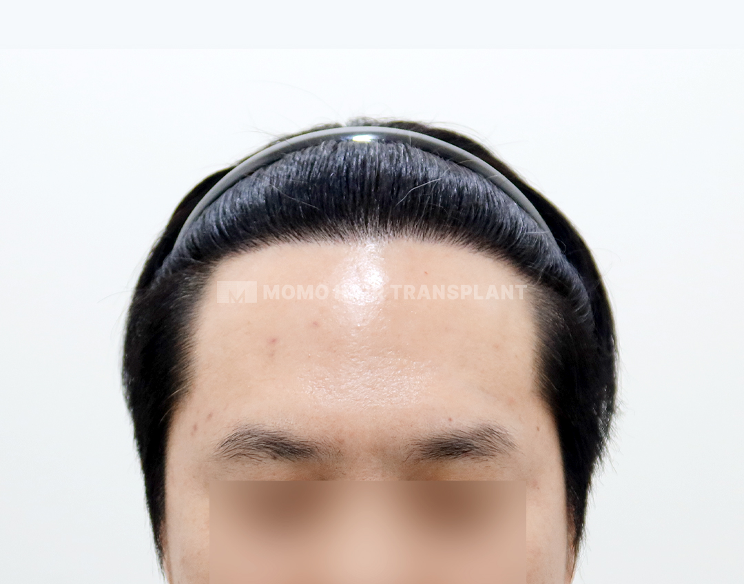 After