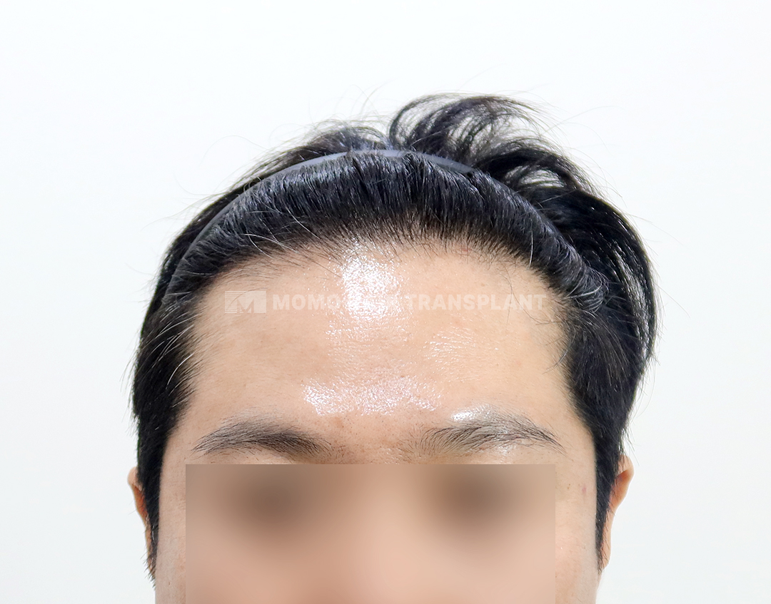 After