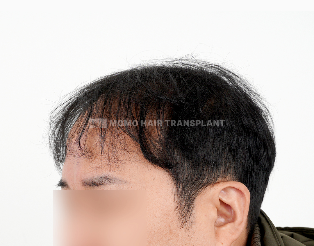 After
