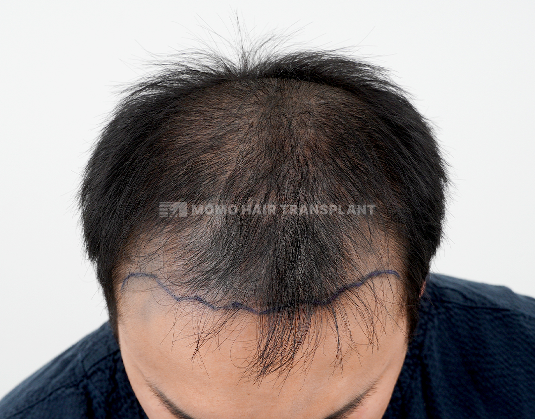 Before