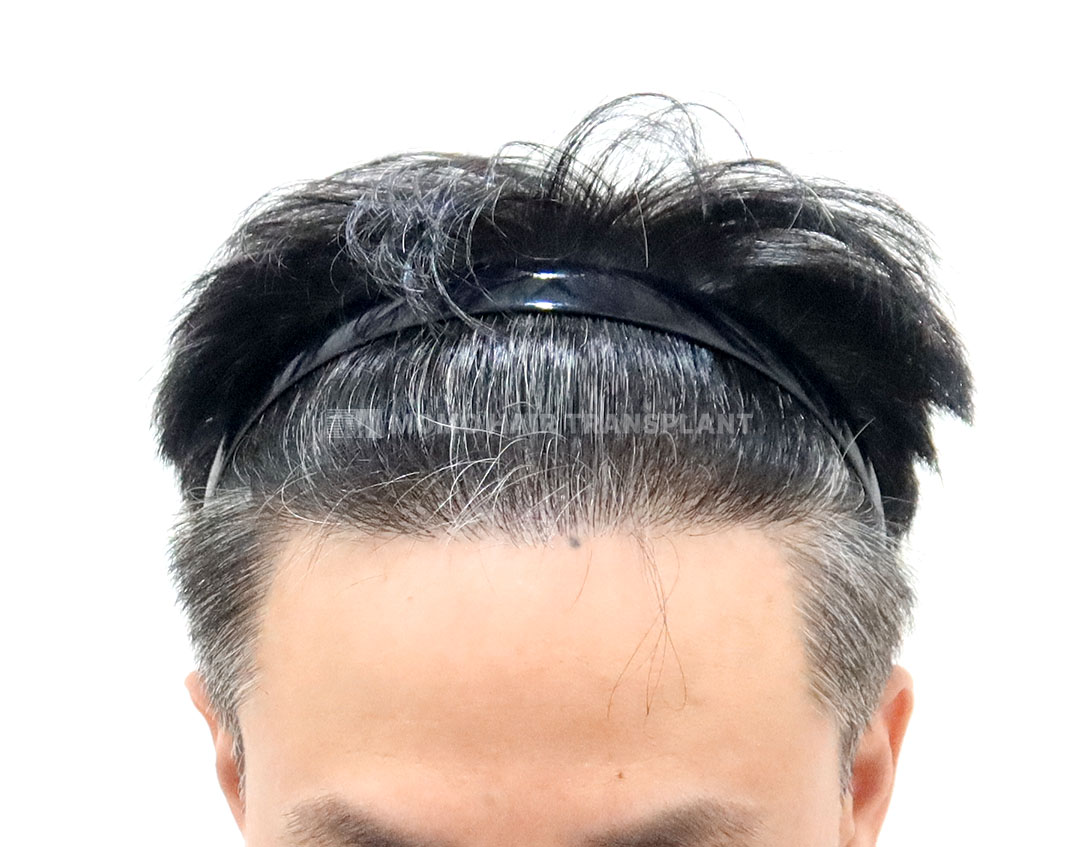 After