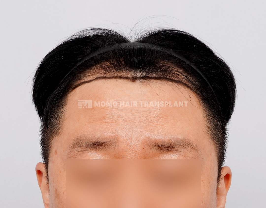 Before