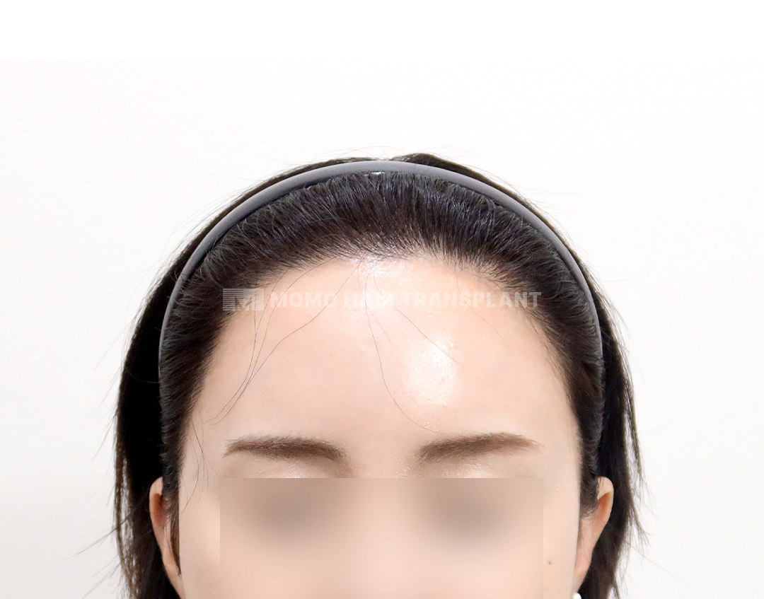 After
