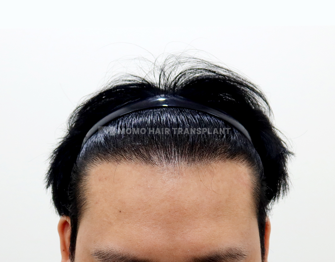 After