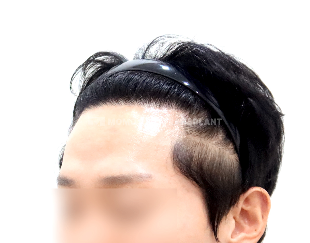 After