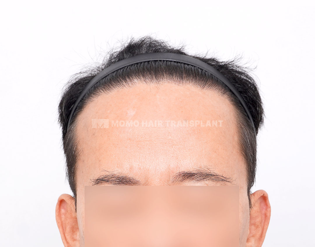 After