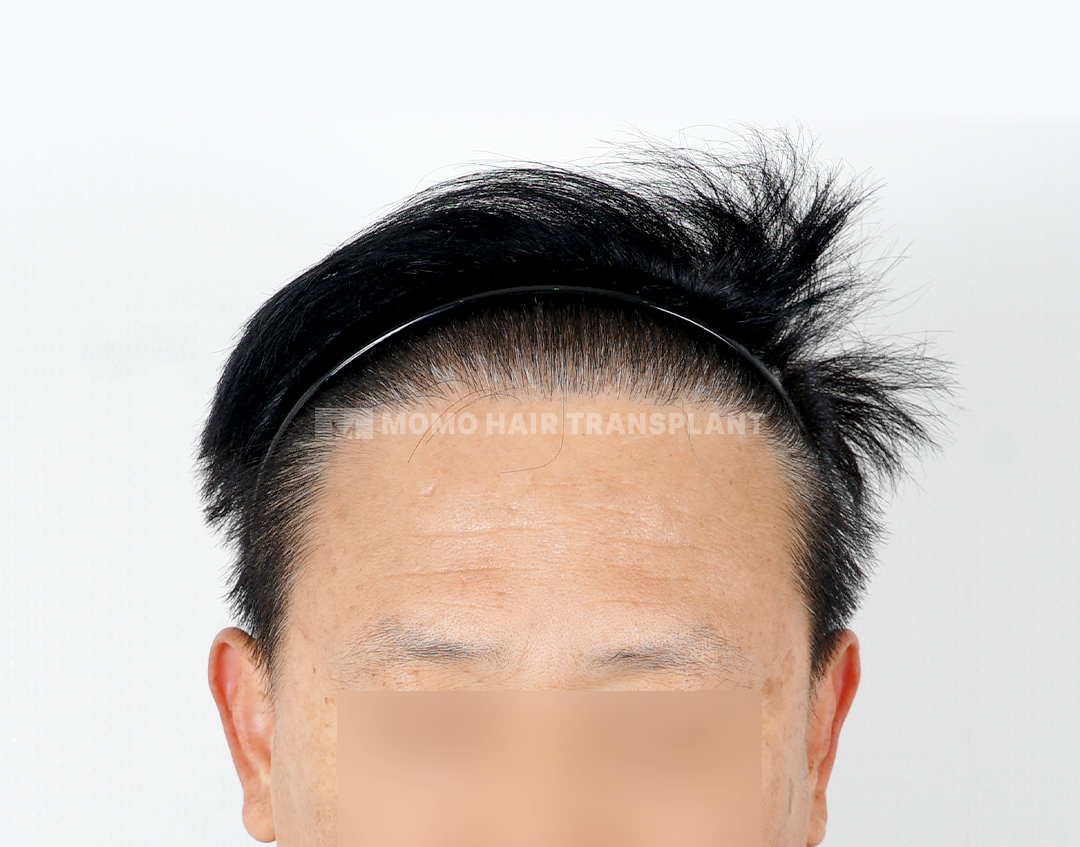 After