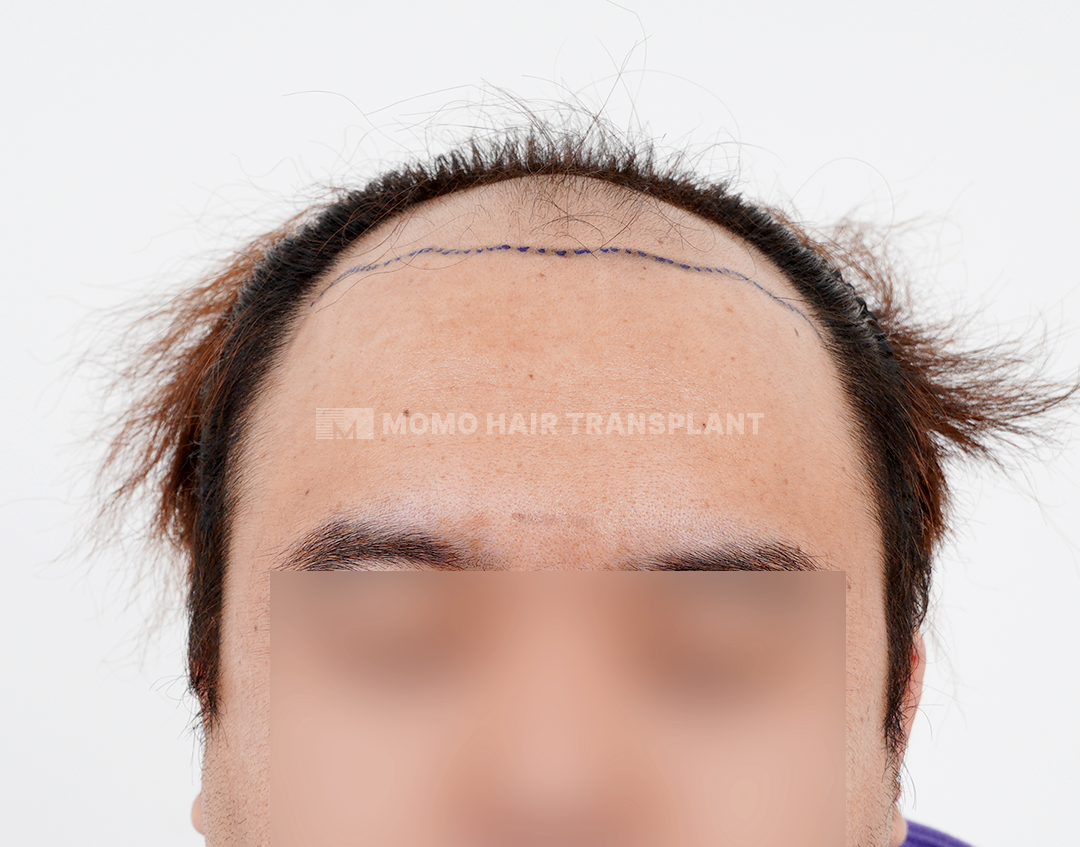 Before