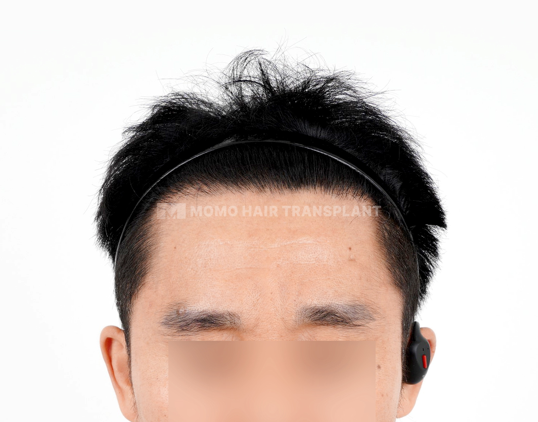 After